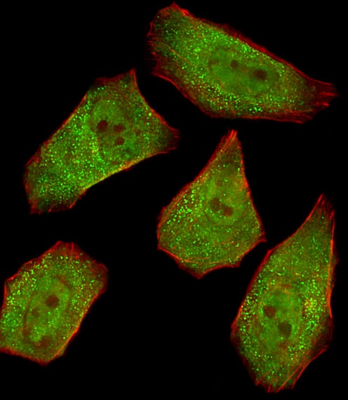 COL4A1 Antibody