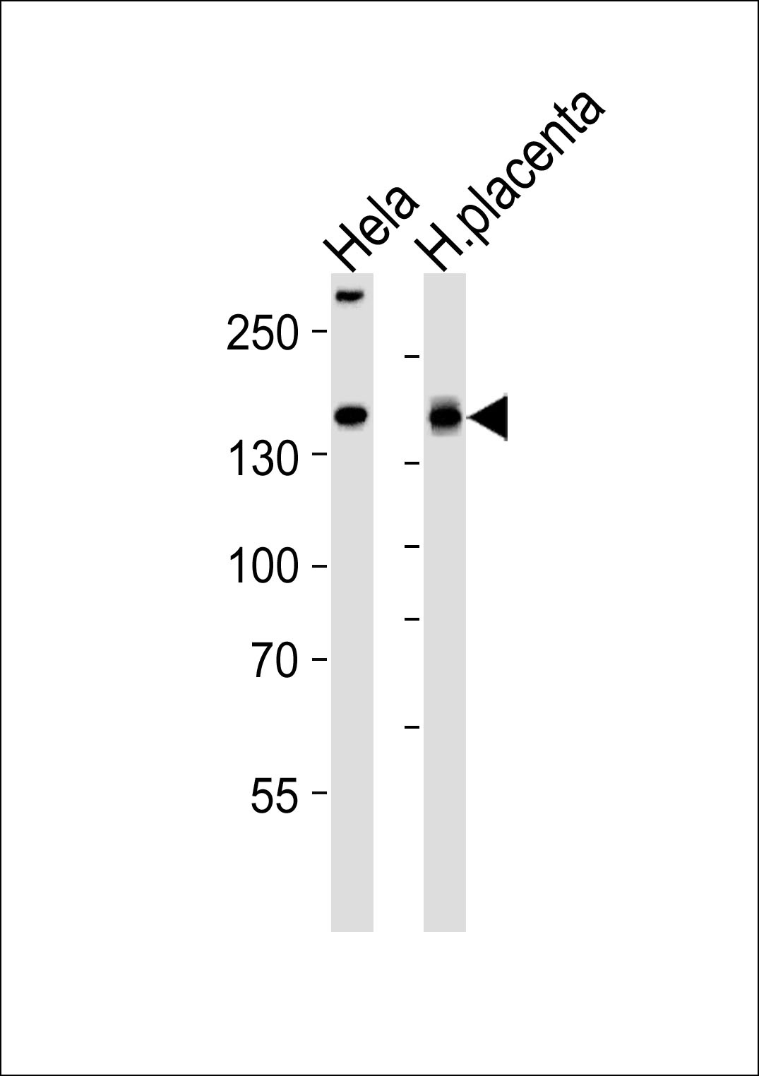 COL4A1 Antibody