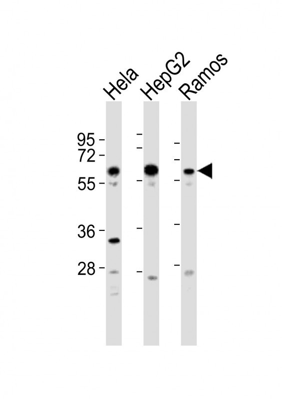 GRK5 Antibody