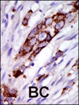 GRK5 Antibody