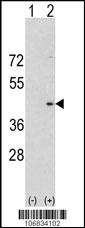 Aurora-A Antibody