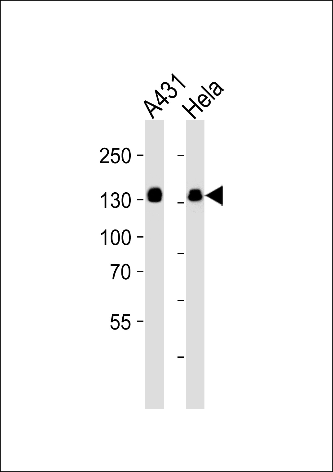 GTF2I Antibody