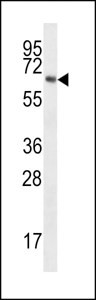 TPTEa Antibody