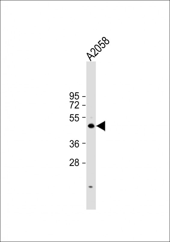 CCNE1 Antibody