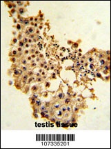 CCNE1 Antibody