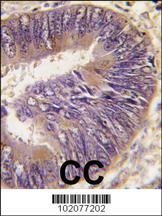 HSC70 Interacting Protein HIP Antibody