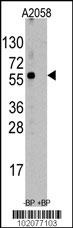 HSC70 Interacting Protein HIP Antibody