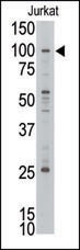 MLLT10 Antibody