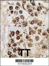 MLLT10 Antibody