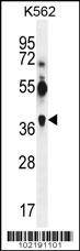 MAGEA12 Antibody