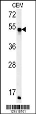 FKBP8 Antibody