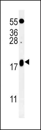 VAMP4 Antibody