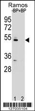 ZDHC2 Antibody