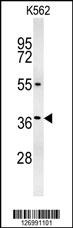 GLP1 Antibody