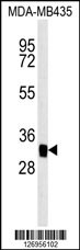 MTCH2 Antibody