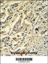 ASM3A Antibody