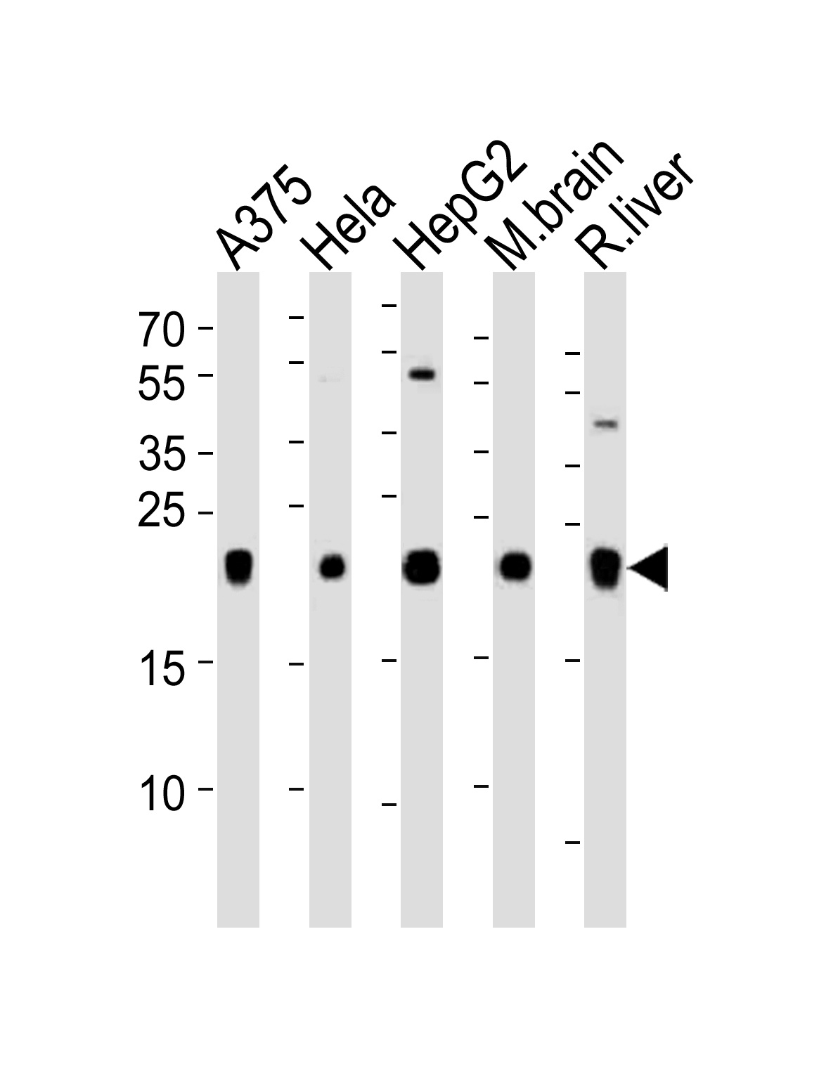 ITPA Antibody