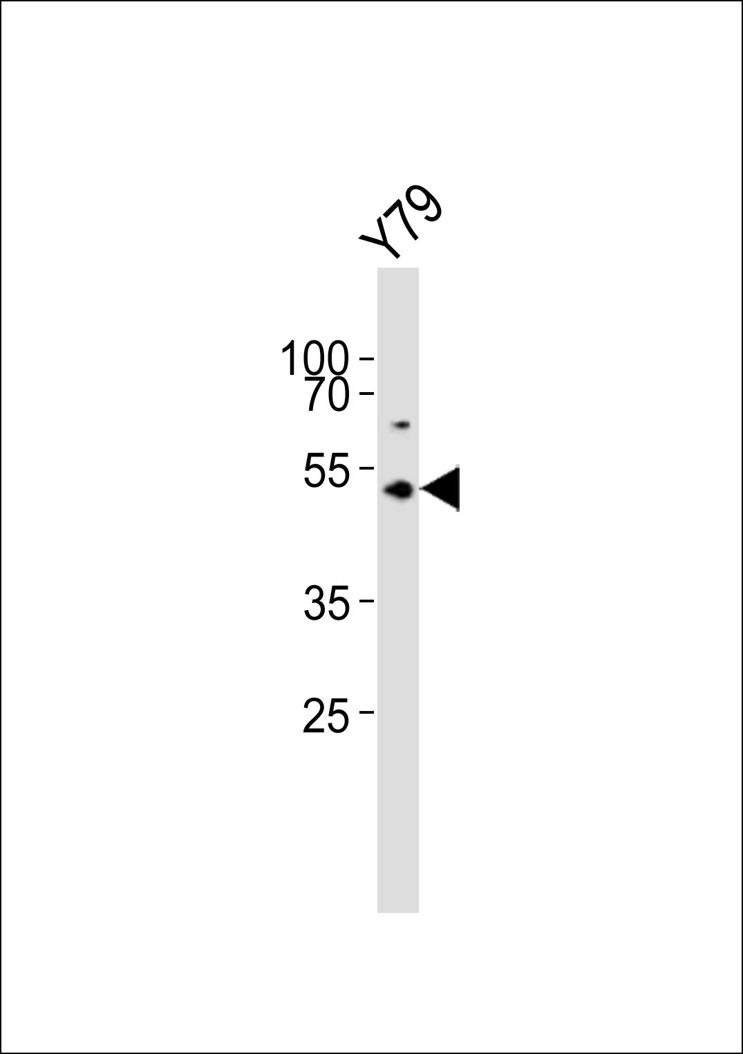 ASMT Antibody