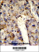 HNRPL Antibody
