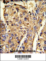 HNRPL Antibody