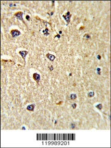 CD166 Antibody