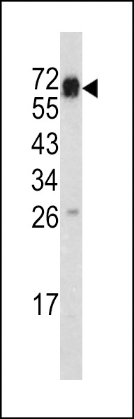 CD105 Antibody