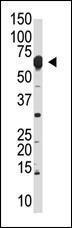 NYREN18 Antibody
