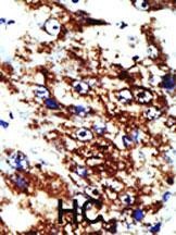 FDPS Antibody