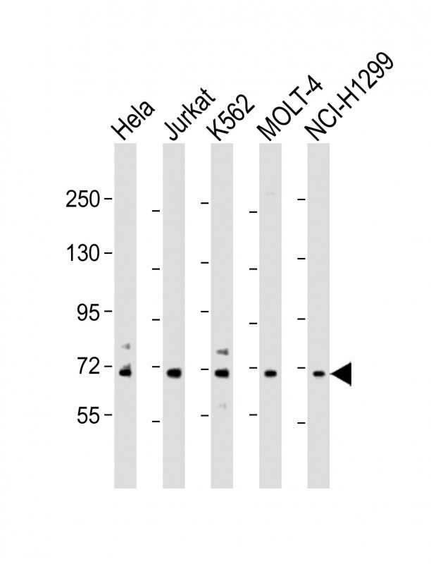 NUP85 Antibody