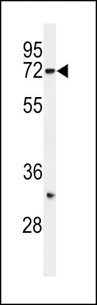 HRD1 Antibody