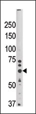 SYVN1 Antibody