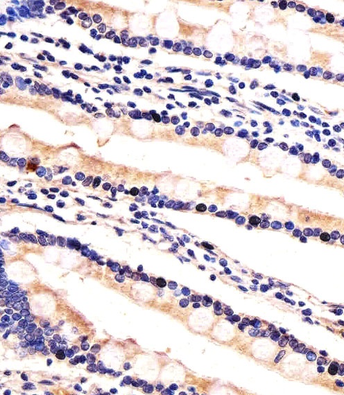 HIP2 Antibody
