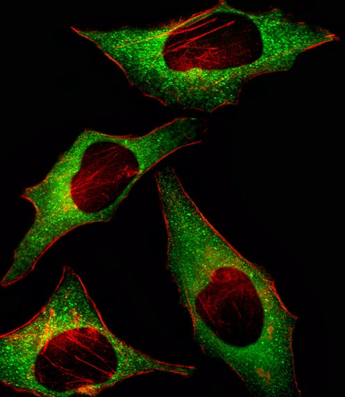 HIP2 Antibody