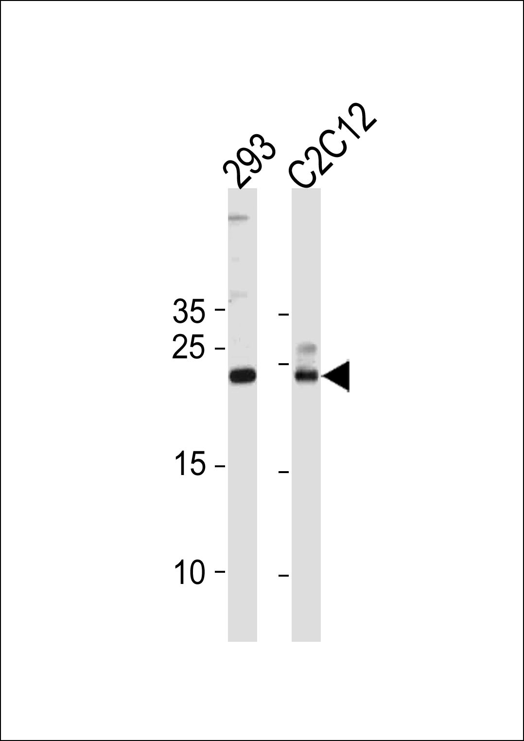 HIP2 Antibody