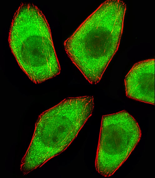 STRADA Antibody