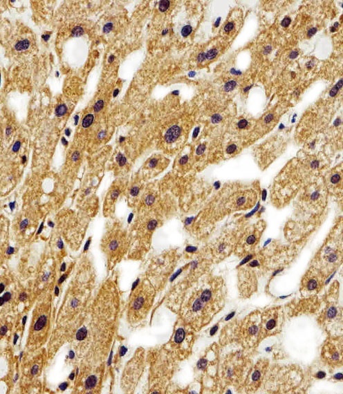 STRADA Antibody