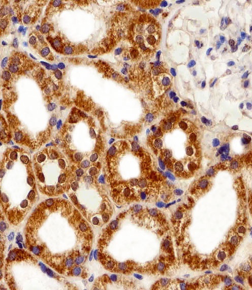 FBXL17 Isoform 2 Antibody