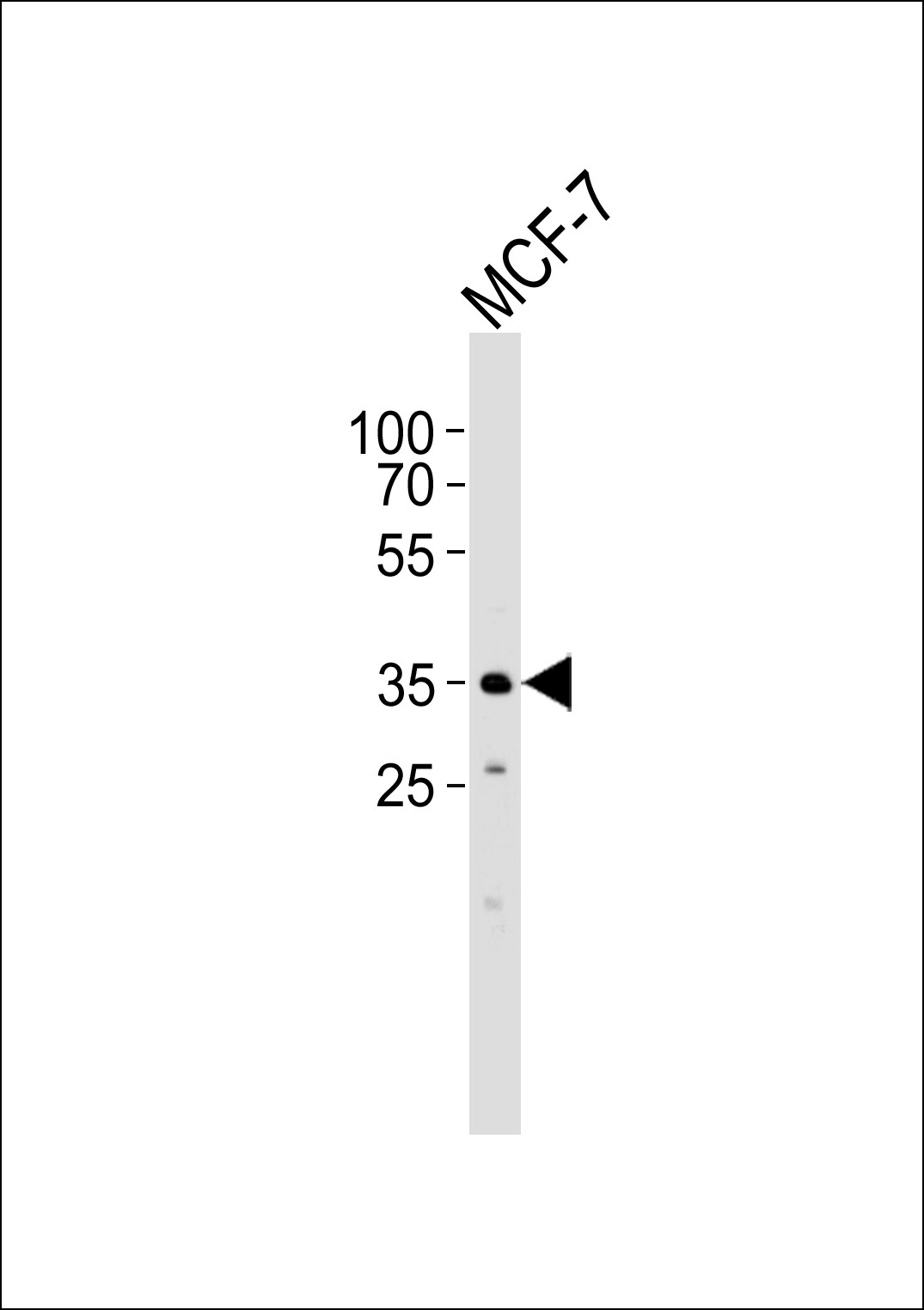 FBXL17 Isoform 2 Antibody