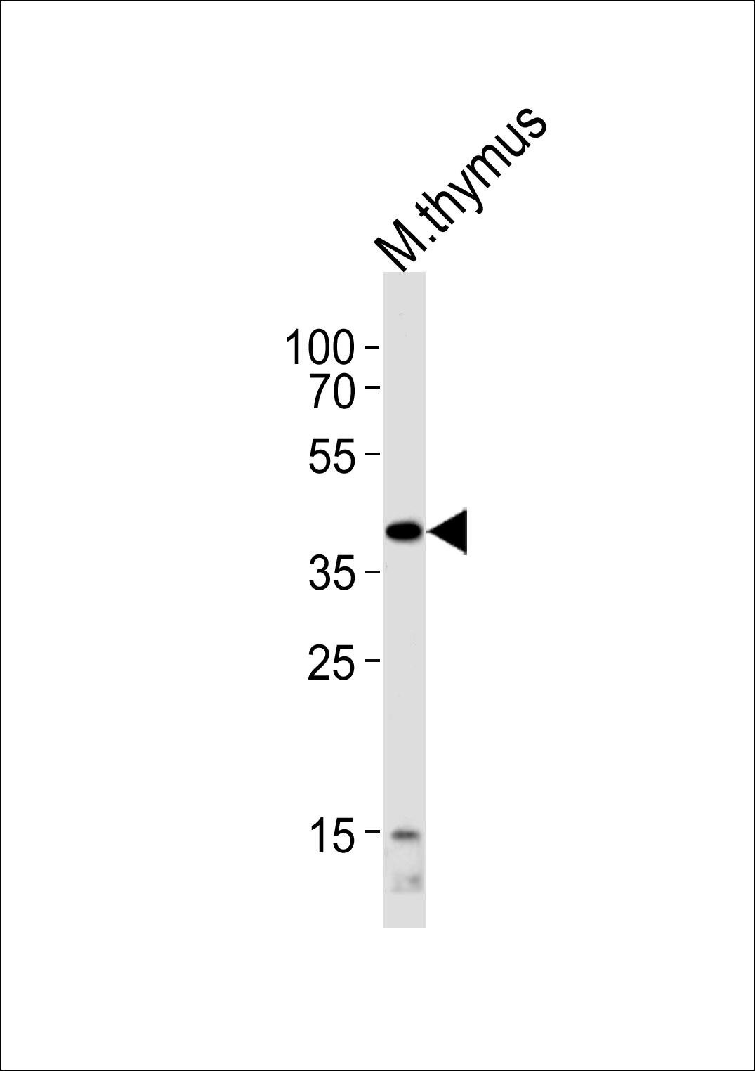 Mouse Tfap2a Antibody