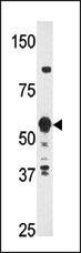 HDBP2 Antibody