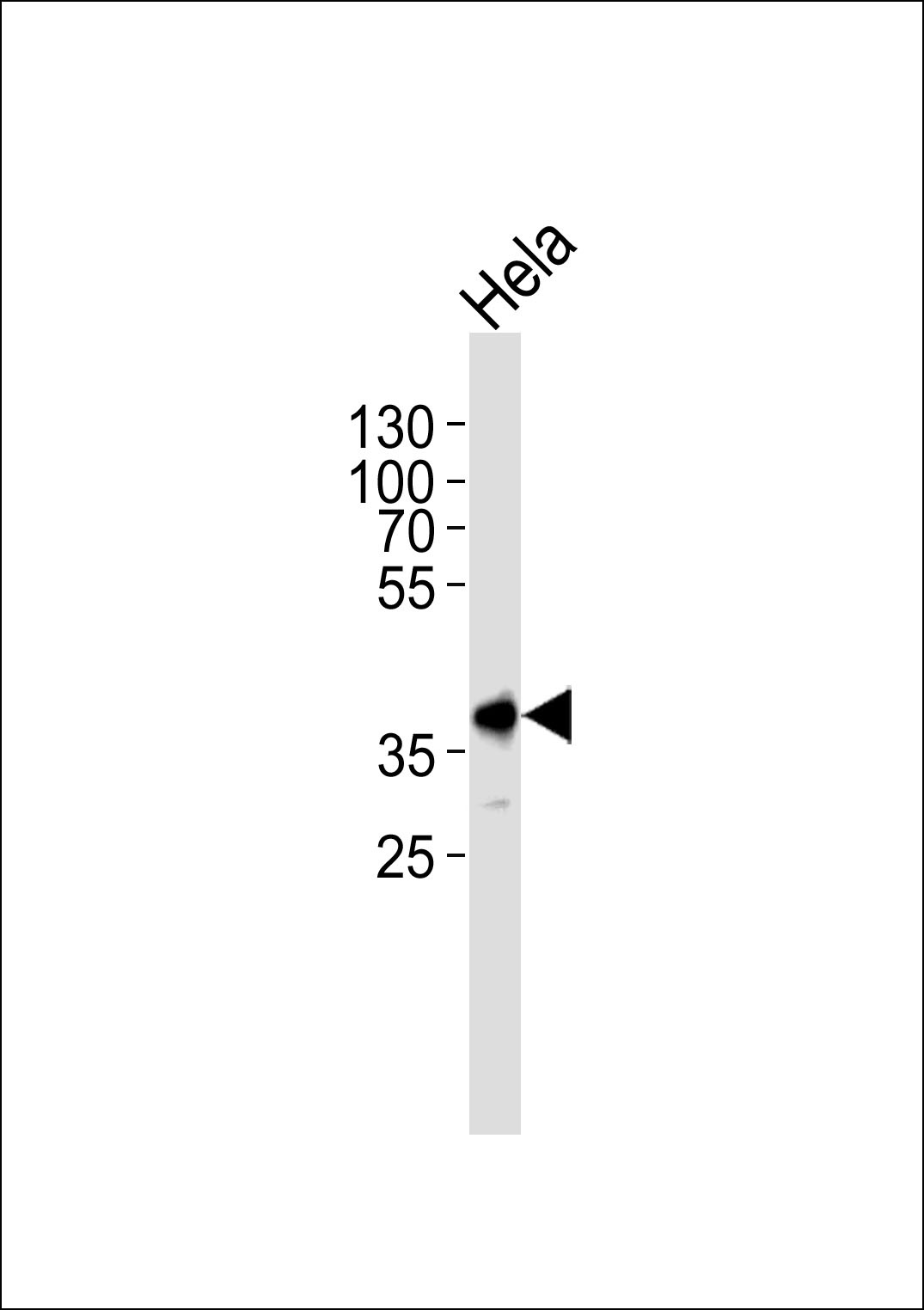 Mouse Pbk Antibody