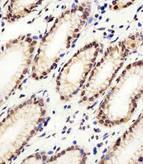 Cellular Apoptosis Susceptibility Antibody