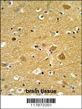 TNPO1 Antibody