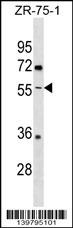 ENTPD5 Antibody