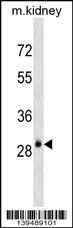 AQP3 Antibody