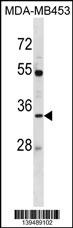 AQP3 Antibody