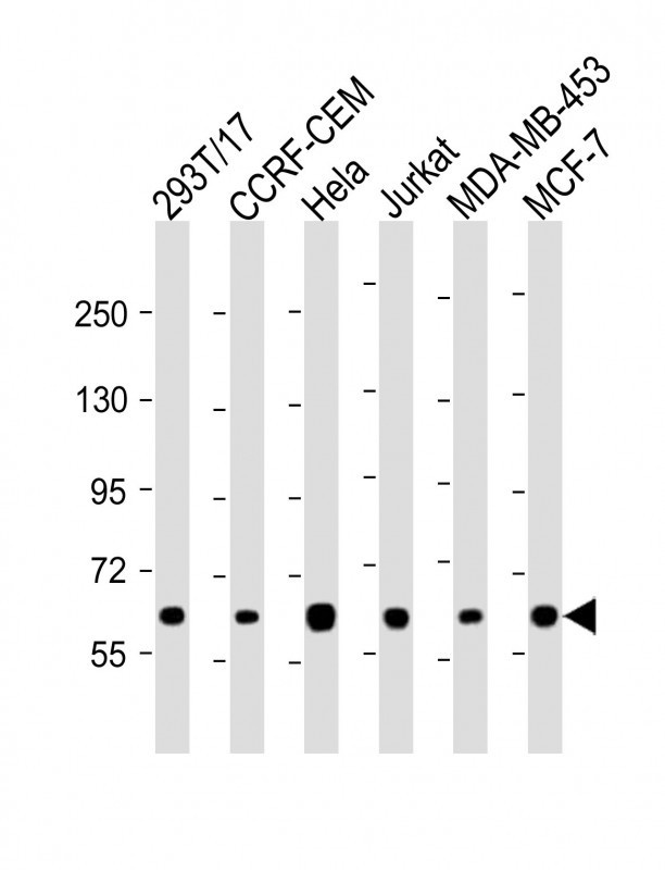 RNF31 Antibody