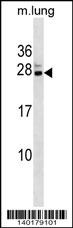 Mouse Cbx5 Antibody
