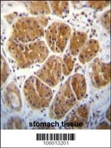 EIF2C2 Antibody