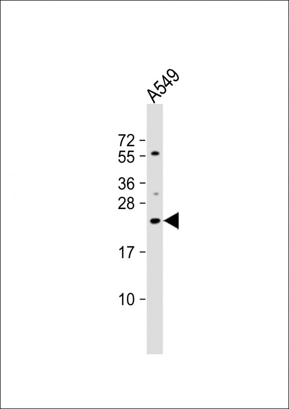 ECSCR Antibody